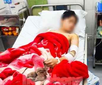 Chó cắn người thì chủ phải chịu những trách nhiệm gì theo quy định?